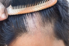 Rüyada Saçkıran Olduğunu Görmek Rüya Yorumu ve Anlamı