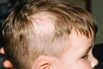 Saçkıran Sarımsak